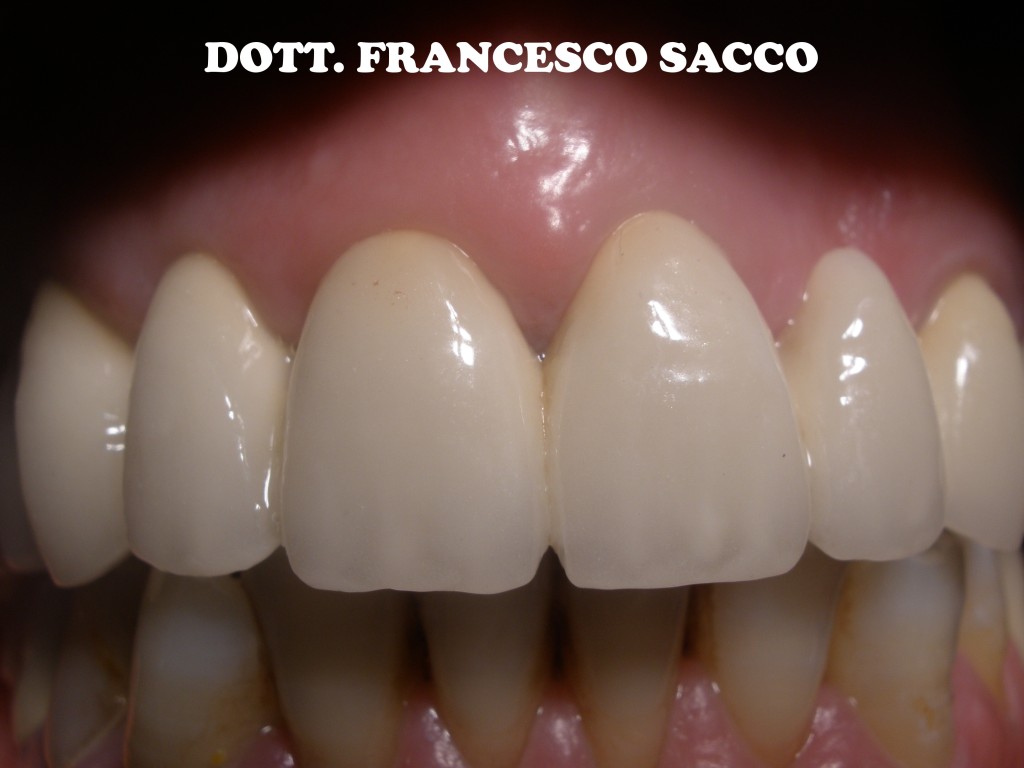 Centro Implantologia Dr. Francesco sacco